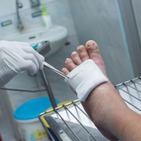 زخم‌های دیابت، قاتل ناشناخته