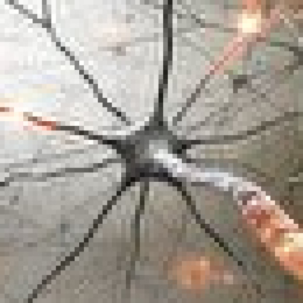 کشف کنید: اسرار بیماری ام اس و راه‌های مقابله با آن!