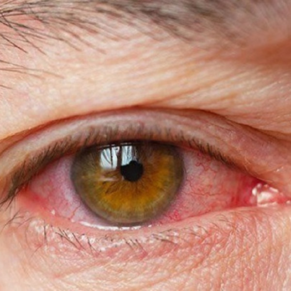 ۱۰ راهکار جذاب برای کاهش فشار چشم و بهبود بینایی