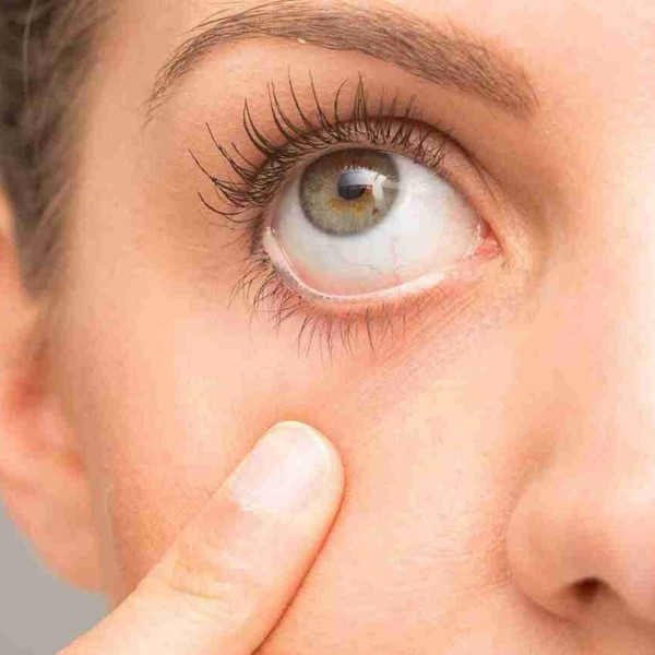 با خنده، از بشری بیمار و غمگین به یک آدم خوشبخت و سرحال تبدیل شوید – راه حل جذاب برای درمان بیماری چشمی