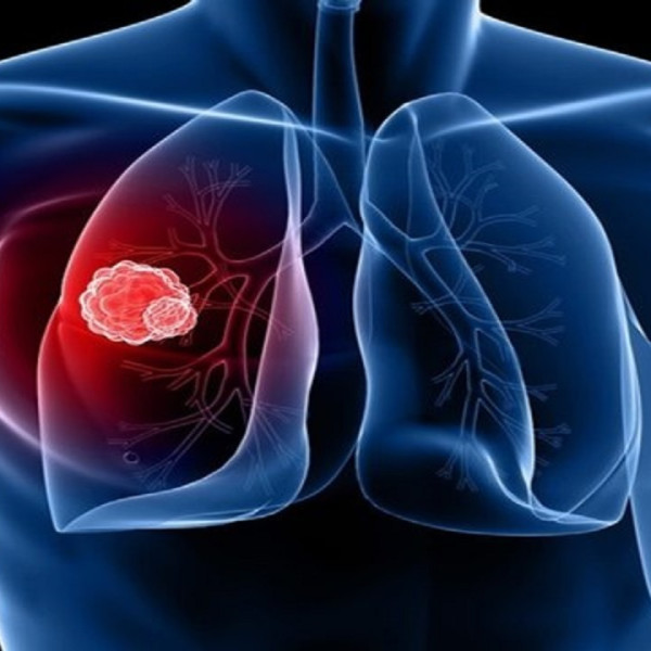 هولد آن! نگران نباشید، آمبولی ریه چیست و این علائمی که دارد را به صورت گرافیکی بررسی کنید!