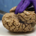 کشفی شگفت‌انگیز: زومی بی‌سابقه به عمق هستی مغز انسان!