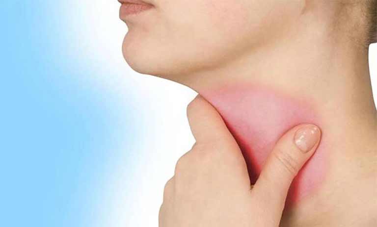 اصابت به آلرژی گلو: آشنایی با علائم، علت ها، راه های پیشگیری و درمان