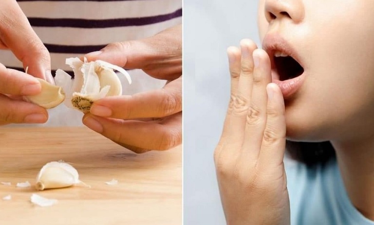 راهکارهای جادویی و بی‌دردسر برای خلاصی شگفت‌انگیز از بوی سیر در دهان و دستان شما!