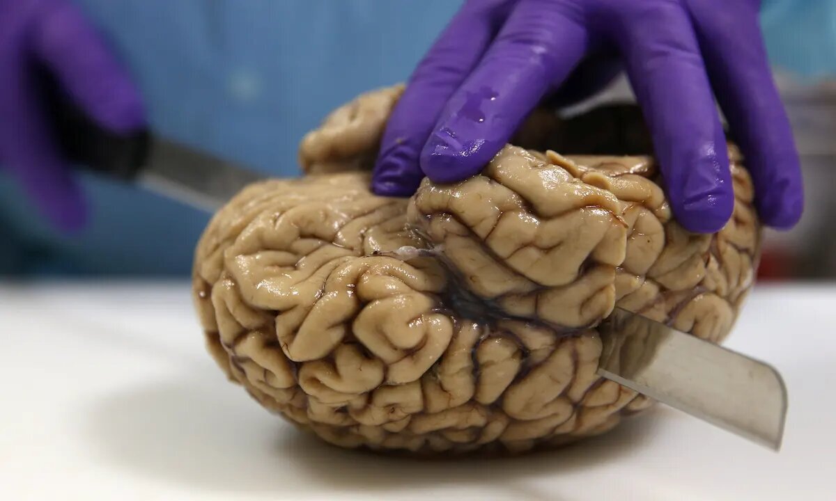 کشفی شگفت‌انگیز: زومی بی‌سابقه به عمق هستی مغز انسان!