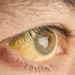 6 ویتامین کلیدی برای حفظ دید: جلوگیری از کم بینایی با مصرف هوشمندانه!