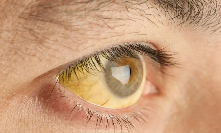 6 ویتامین کلیدی برای حفظ دید: جلوگیری از کم بینایی با مصرف هوشمندانه!