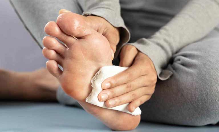 دست و پایی که همیشه مرطوب است: چرا کف دست و پایتان عرق می‌کند و چگونه آن را مهار کنید!
