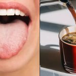 هشدار! نشانه‌ای روی زبان شما که نوشیدن قهوه را ممنوع می‌کند!