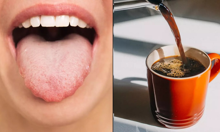 هشدار! نشانه‌ای روی زبان شما که نوشیدن قهوه را ممنوع می‌کند!