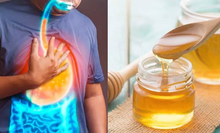 کشف راهی شیرین برای شکست رفلاکس معده: عسل، درمانگر طبیعی شما!