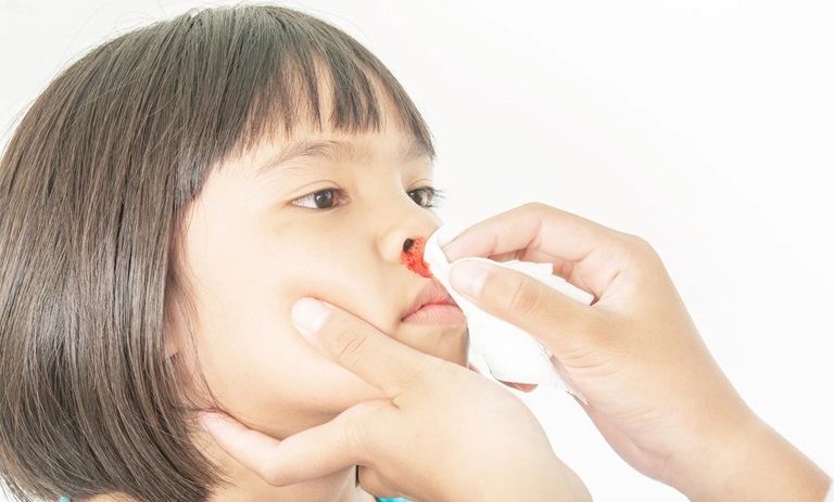 شکلات خوناشق قطع کننده دماغ!