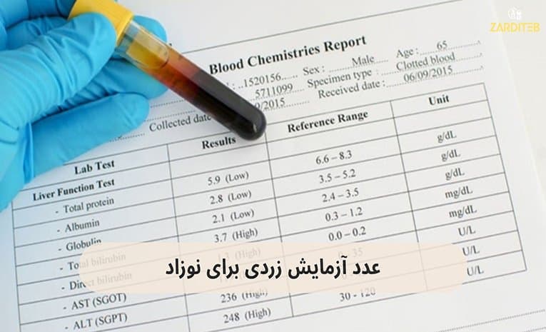 درجه زردی نوزاد+درجه بدی زردی نوزاد