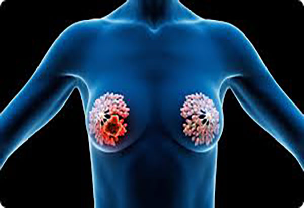 رمز و راز خواب پستان: از نگاه مردان و زنان یا زنان یکدیگر!