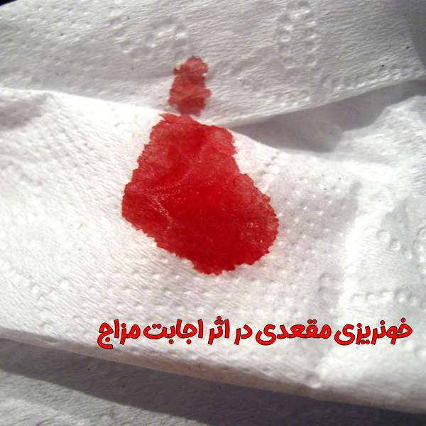 سوزش مقعد هنگام اجابت مزاج | دلایل و راه‌های درمان