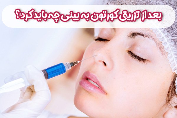 بعد از تزریق کورتون به بینی چه باید کرد؟