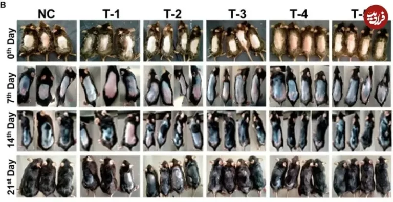 داروی تازۀ «ریزش مو» که به طور تصادفی کشف شد