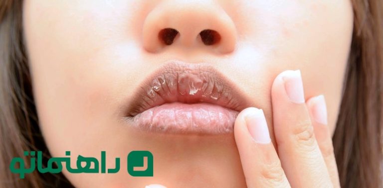 رژ لب برای خشکی لب ؛ نرم کردن لب با خوشرنگ ترین رژ ها