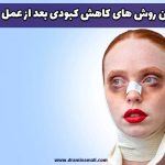 بهترین روش های کاهش کبودی بعد از عمل بینی