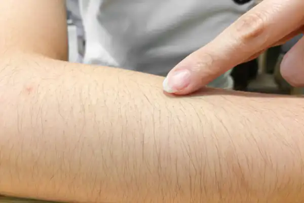 تعبیر خواب موی دست زن برای زن متاهل و باردار و دختر مجرد از روانشناسی