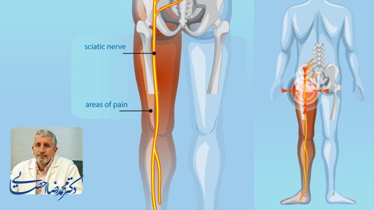 بهترین دکتر سیاتیک در مشهد | چرا انتخاب پزشک درست سرنوشت‌ساز است؟