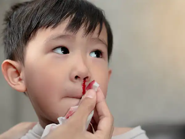 تعبیر خواب خون دماغ شدن برادر برای زن متاهل و باردار و دختر مجرد از روانشناسی