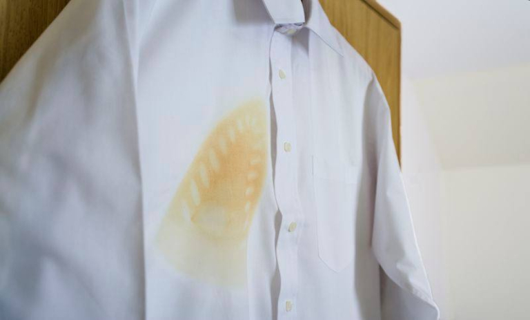 ترفندهای رفع سوختگی و لکه‌های لباس با اتو