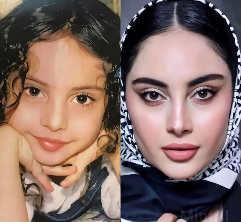 عمل‌های زیبایی ترلان پروانه بالاخره لو رفت! + فیلم