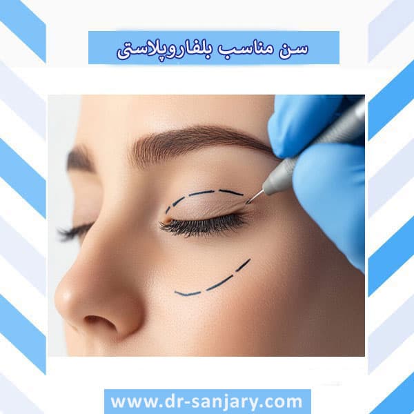 انتخاب سن طلائی برای بلفاروپلاستی که نتیجه را فوق العاده می کند !