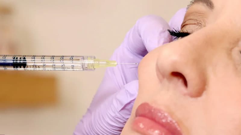 بهترین دکتر تزریق فیلر در شیراز