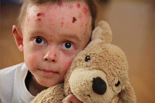 تعبیر خواب بیماری امام صادق + عیادت بیمار و مریضی مادر و پدر و برادر و دیگران