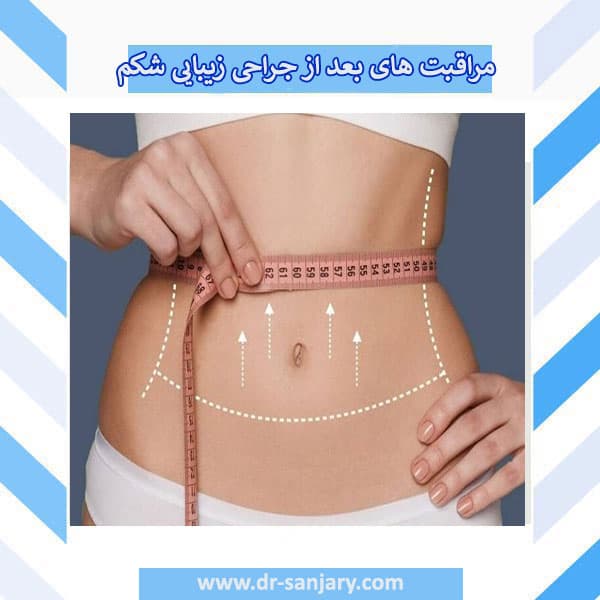 مراقبت های کلیدی که باید بعد از جراحی زیبایی شکم رعایت کنید !