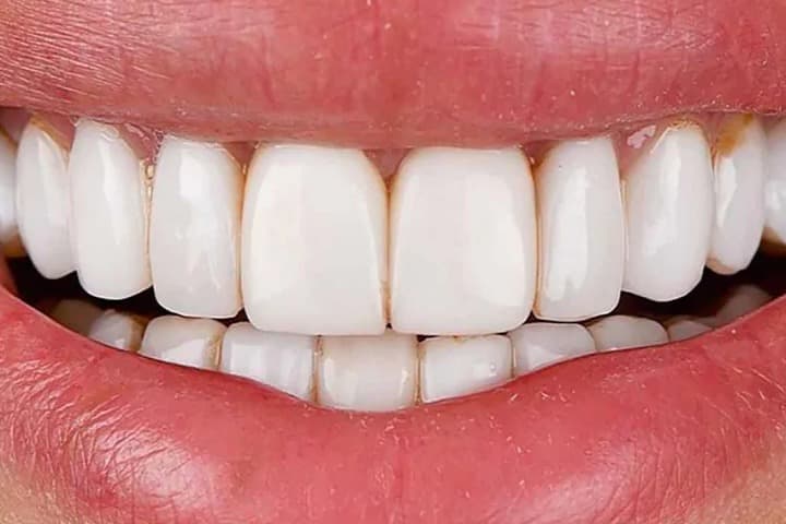 قیمت روز کامپوزیت ای‌پی‌اس آمریکا در ایران