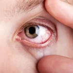 راهکار‌های طلایی برای جلوگیری از خشکی چشم در هوای سرد زمستان