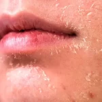 ۵ روش برای مراقبت از پوست در زمستان/ با این چند روش ساده پوست براق و لطیف داشته باشید